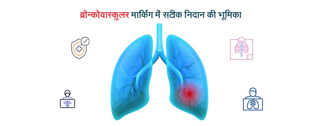 ब्रोन्कोवस्कुलर मार्किंग में सटीक निदान की भूमिका